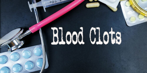 Blood Clotting Disorders – Symptoms, Causes, and More