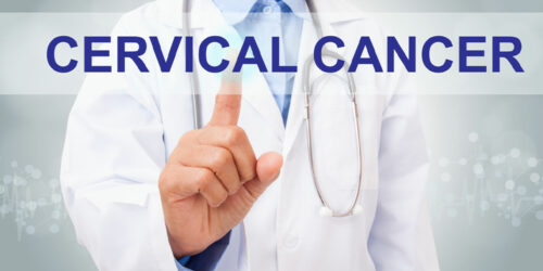 Cervical Cancer – Causes, Risk Factors, Symptoms and More