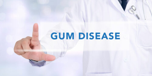 Gum Disease – Symptoms and Remedies