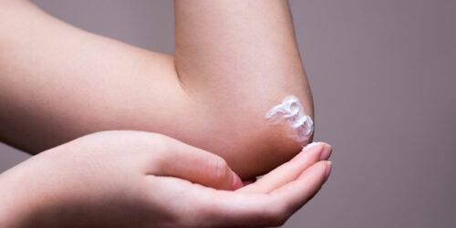 Ringworm – Transmission, Risk factors, and More