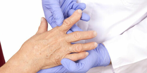4 best remedies for rheumatoid arthritis