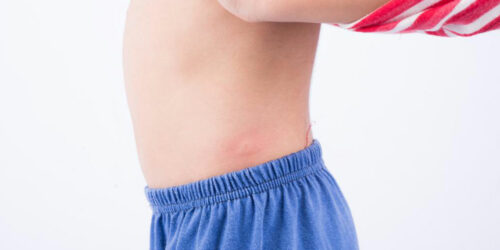 10 common types of skin rashes you should be aware of