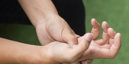 An Overview of Dupuytren’s Disease