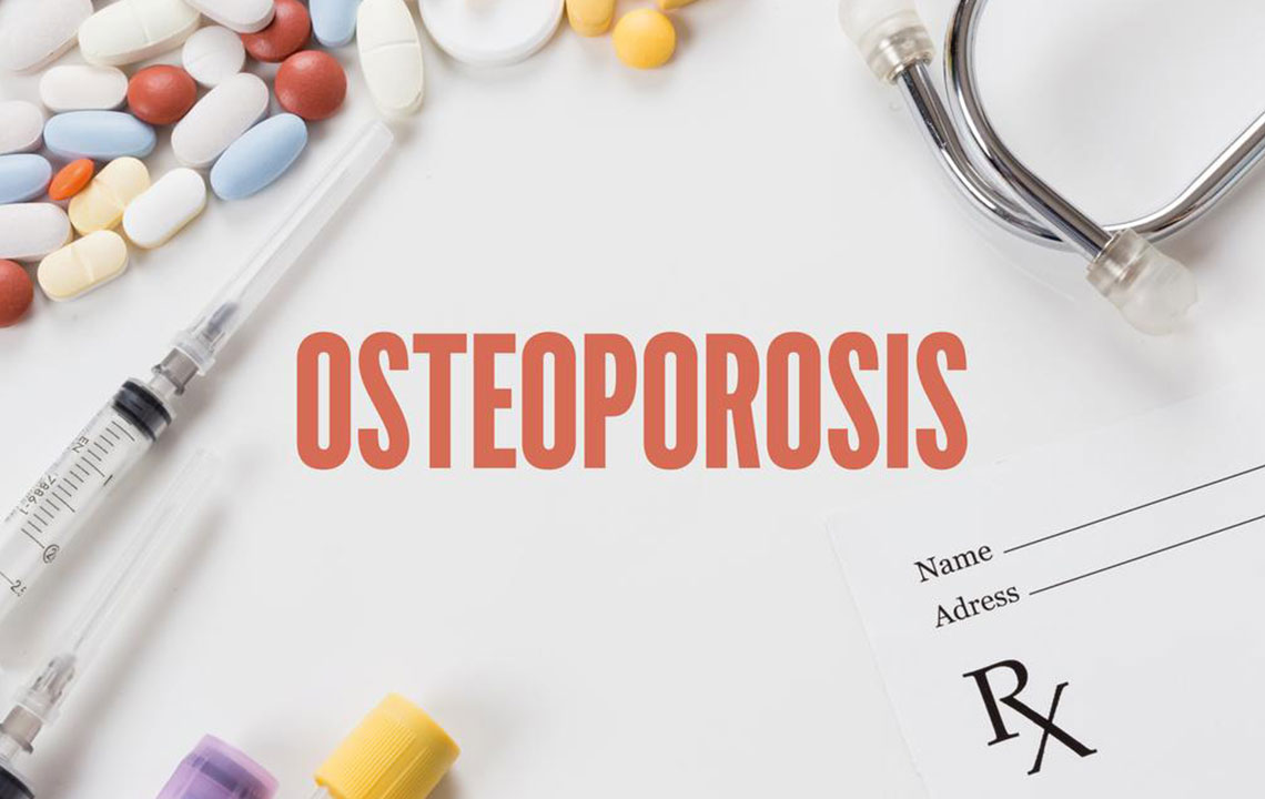 Bone density testing – An important diagnostic tool for osteoporosis