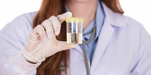 Here’s what you need to know about e coli in urine