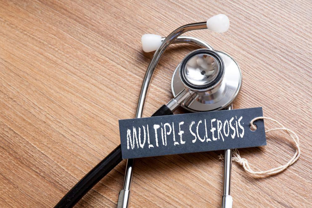 Multiple sclerosis – Things you need to know