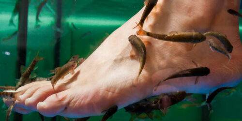 Psoriasis – Types, causes and popular treatments