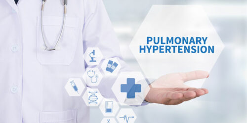 Pulmonary arterial hypertension – Causes, symptoms, and preventive measures
