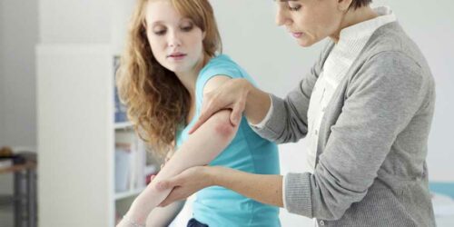 Severe Psoriasis – Treatment Options to Consider