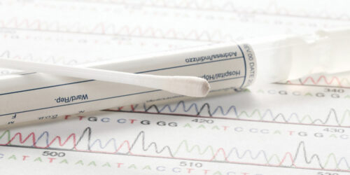 Where are large cotton swabs used