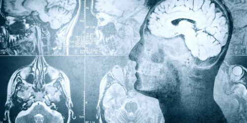 4 Different Types of Treatments for Seizures