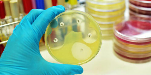 7 Spring Allergy Symptoms