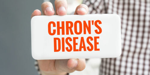 All You Need to Know about Chron’s disease
