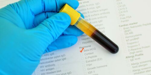 Different Immunotherapy Types to Fight Cancer