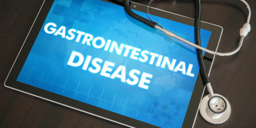 Gastrointestinal stromal tumor – Risk factors and survival rate