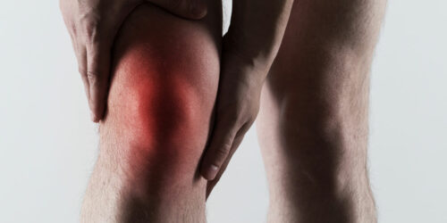 Gout – causes, symptoms, and treatment