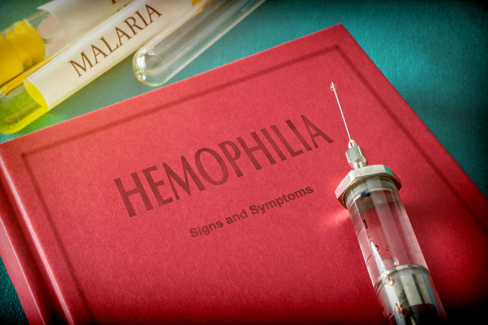 Hemophilia – 4 main symptoms and their severity