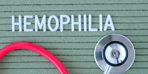 Hemophilia – Early signs and ways to manage the condition