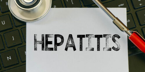 Hepatitis C – Causes, Symptoms, and Treatment