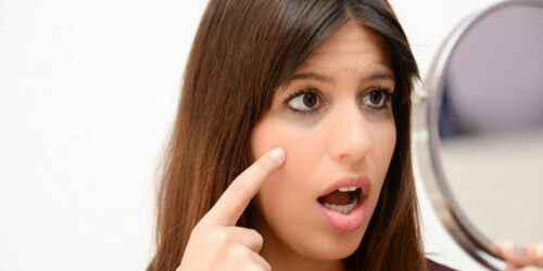 Here’s How to Fix Your Dark Circles Like a Pro