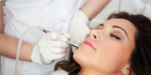 Here’s what you can do for your age spots