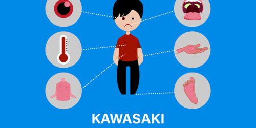 Kawasaki disease – causes and symptoms