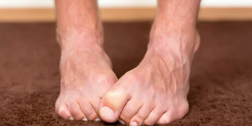 Neuropathy Foot Pain – Symptoms, Causes, Treatments and More