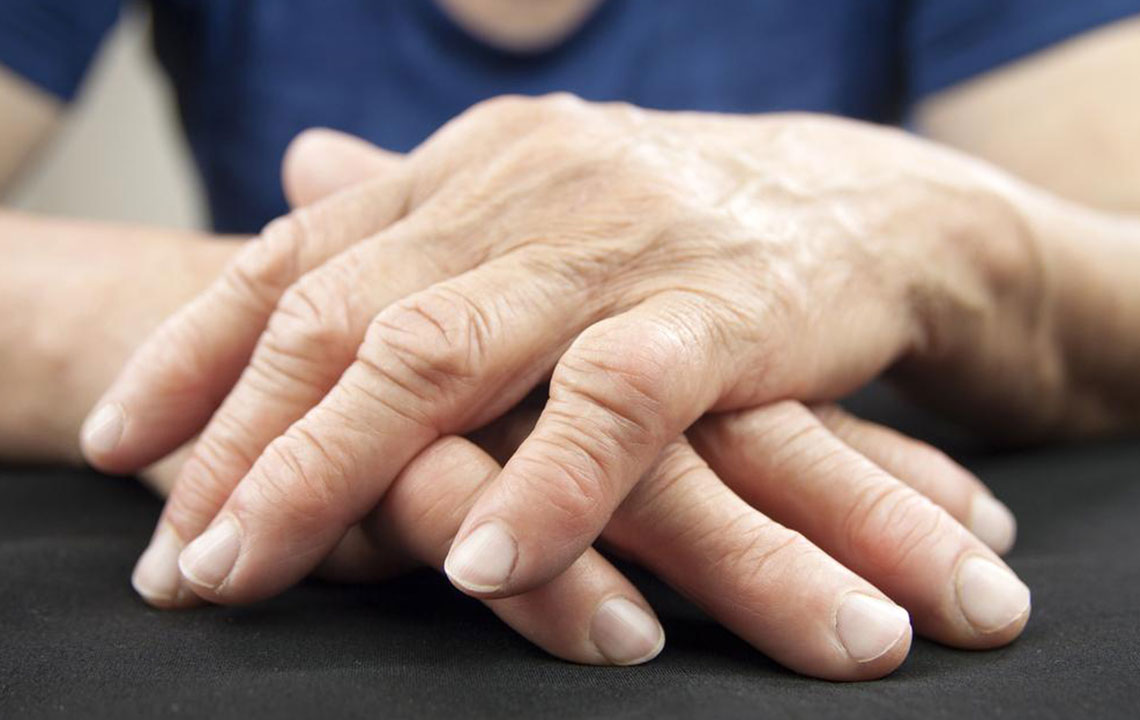 Rheumatoid Arthritis – Symptoms, Causes, and Remedies