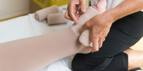 Exercises Beneficial for Lymphedema