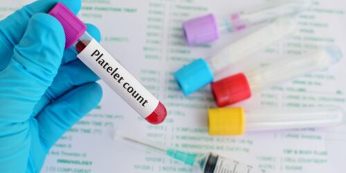 Low Platelet Count Treatment Effective Approaches and Considerations